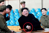 金正恩右手腕贴白纱布疑受伤