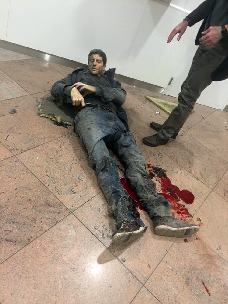 图:一名男子在布鲁塞尔机场爆炸案中受伤,腿上鲜血直流 美联社